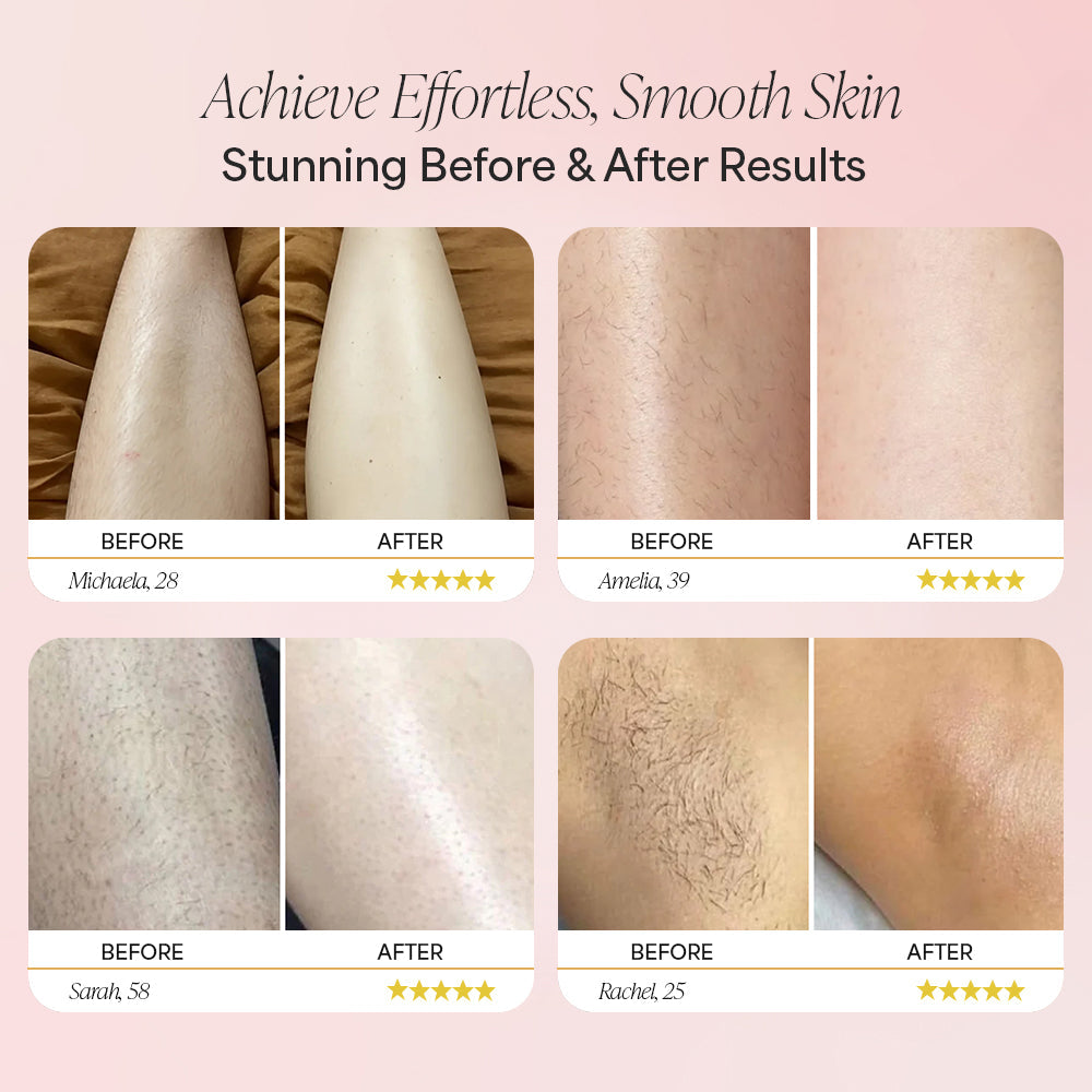 Dermave™ Trimmer 2.0
